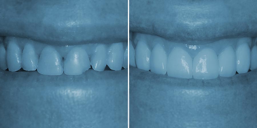 dentistry before and after photos